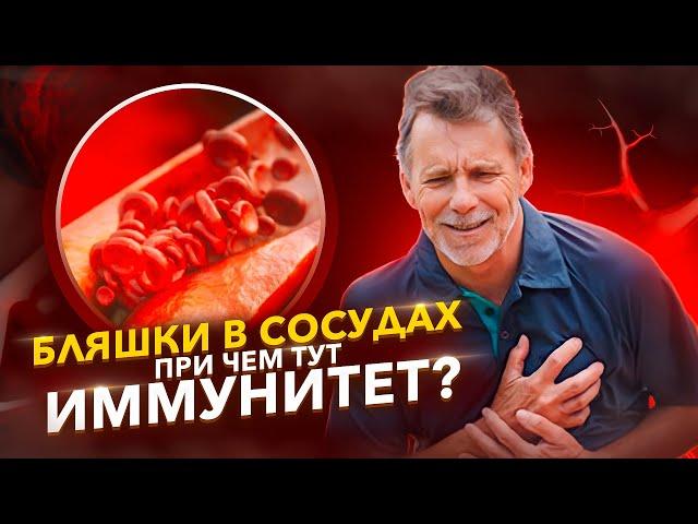 Как очистить сосуды от бляшек? Рассказываем о методе Лимфатек.