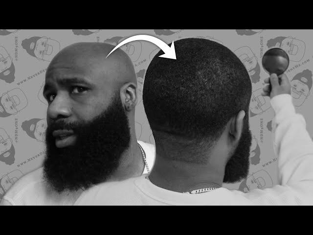 Natural Hairline Replacement  | EASY Non Surgical Method  | SMP Tattoo Alternative @NateMatthews