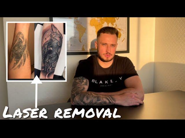 Laser tattoo removal (cover ups/process and overall experience)