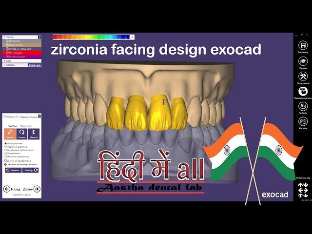 zirconia facing design exocad HINDI & exocad bridge design, exocad smile design,