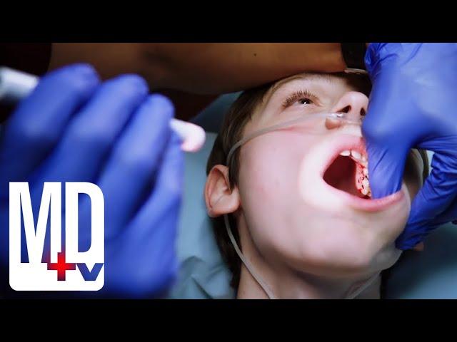 Poor Oral Hygiene Ends in Brain Infection | Chicago Med | MD TV
