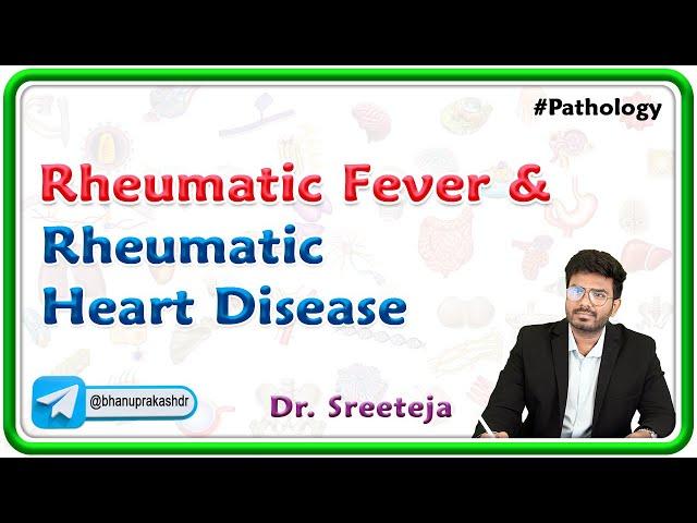 6: Rheumatic Fever and Rheumatic heart disease  | Pathology USMLE Step 1