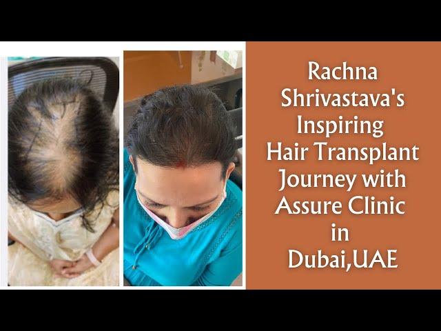 Rachna Shrivastava's Inspiring Hair Transplant Journey with Assure Clinic in Dubai,UAE