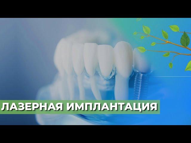 Лазерная имплантация зубов ️