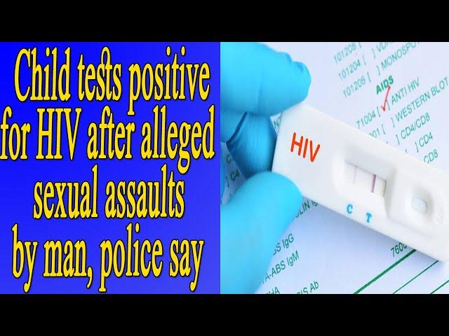 Child tests positive for HIV after alleged sexual assaults by man, police say