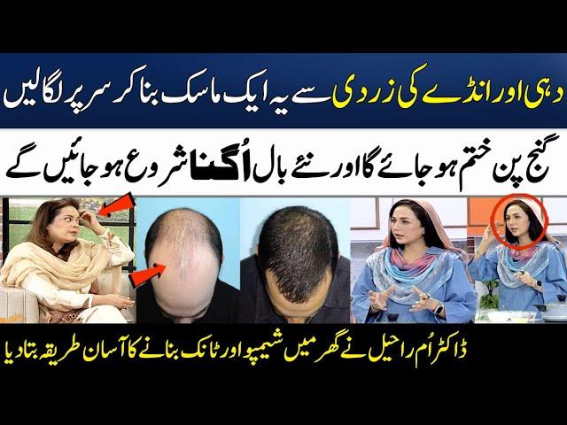 Ganjapan Aur Girtay Baalon Ka Asan Desi Ilaj (100%) | Dr Umme Raheel | Madeha Naqvi | SAMAA TV