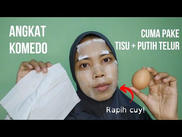 Cara Angkat Komedo Pakai Putih Telur | Sabrina Haisya