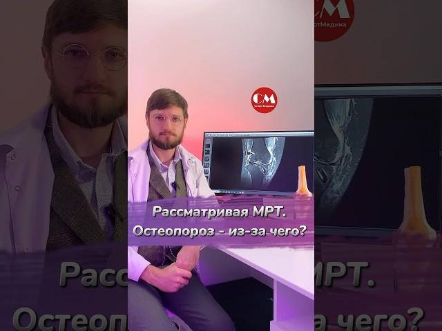 Остеопороз - из-за чего? #спортмедика #МРТ #рассматриваямрт #колено #knee #nopain #остеопороз