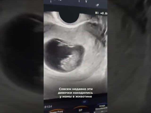 Поздравляем родителей с рождением малышей!