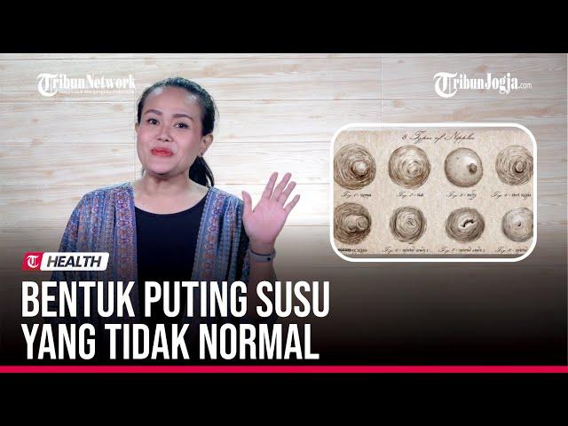  BAGAIMANA BENTUK PUTING SUSU YANG TIDAK NORMAL ?