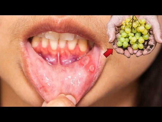 अंगूर खाने के फायदे | Angur khane ke fayde | Angoor khane ke fayde | Grapes benefits