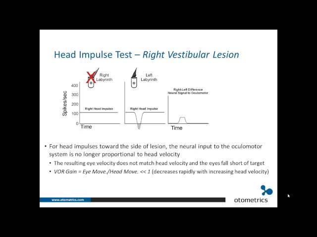 ICS Impulse vHIT: Introduction and overview of underlying physiology