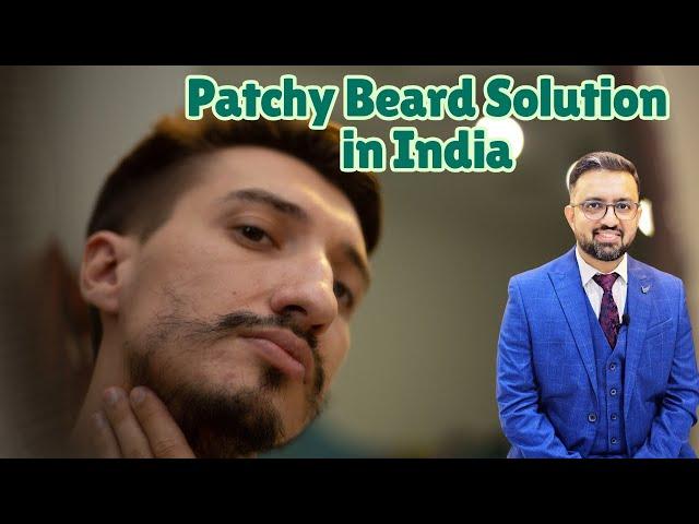 Patchy Beard Fix in India FAST!  | Best Treatments by Top Surgeon