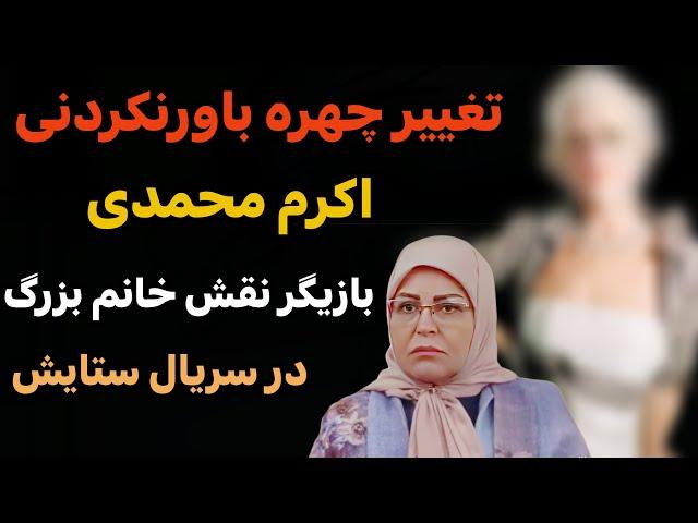 تغییر چهره شوکه کننده اکرم محمدی | باورنمیکنید چه شکلی شده