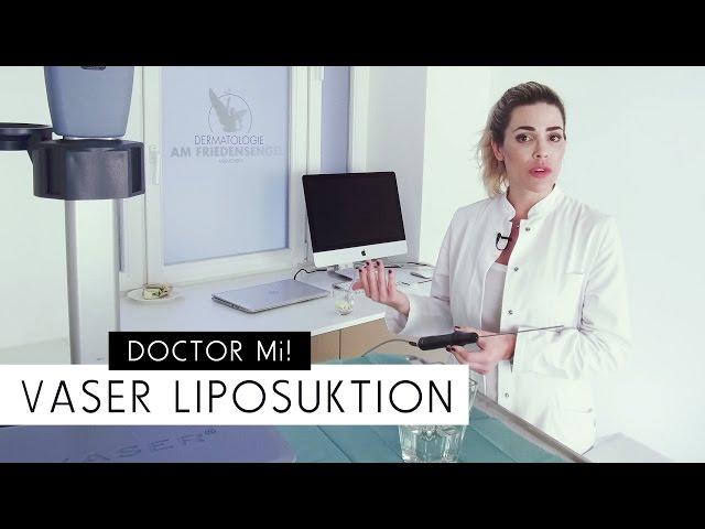 Fettabsaugen mit VASER® – Liposuktion mit Straffungseffekt | DOCTOR Mi! Folge 1