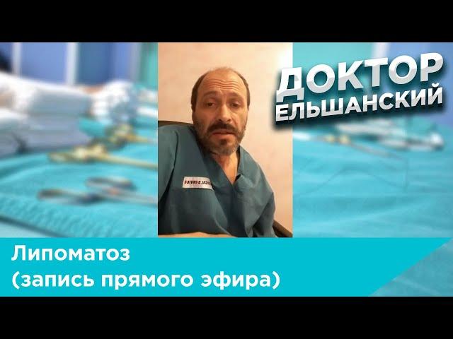Липоматоз (запись прямого эфира)