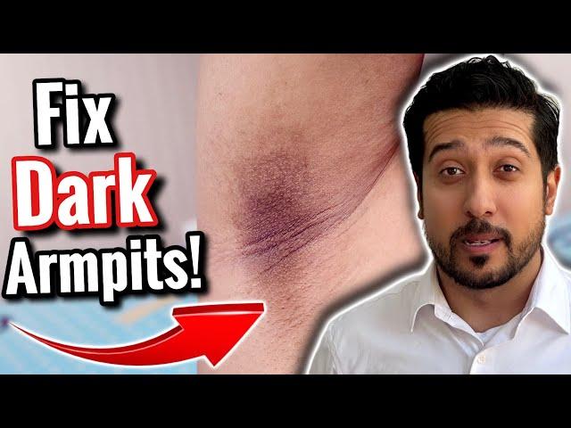 How to Fade Dark Underarms FAST | This Will Lighten Dark Armpits (DIY)