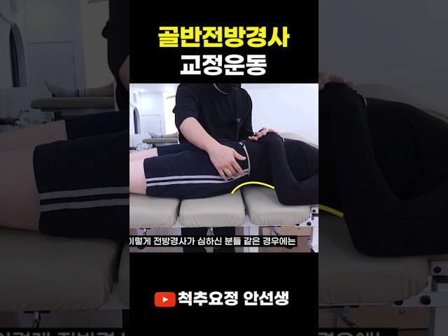 골반전방경사 교정운동, 허리가 과도하게 꺾인다면 의심해보세요!!!