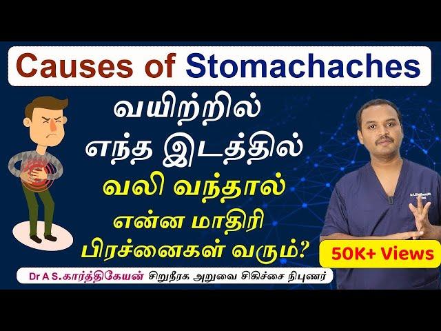 Stomach Pain:  Stomach Pain Explained in Tamil | Dr. A S Karthikeyan