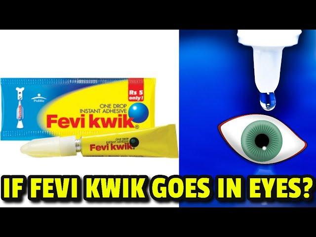 15 Shocking Facts of What if Fevi Kwik goes in your Eyes