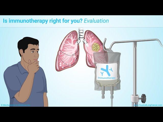 Immunotherapy Treatments for Non-Small Cell Lung Cancer (NSCLC)