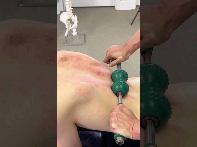 LOUD *CRACKS*  Steamrolling A Tight Back!! #shorts #chiropractor