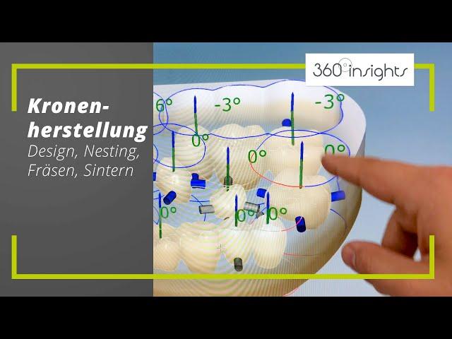 Kronenherstellung (Design, Nesting, Fräsen & Sintern | 360°zahn insights