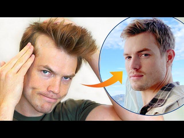 How I Stopped My Receding Hairline (Men's Hair Loss Guide)