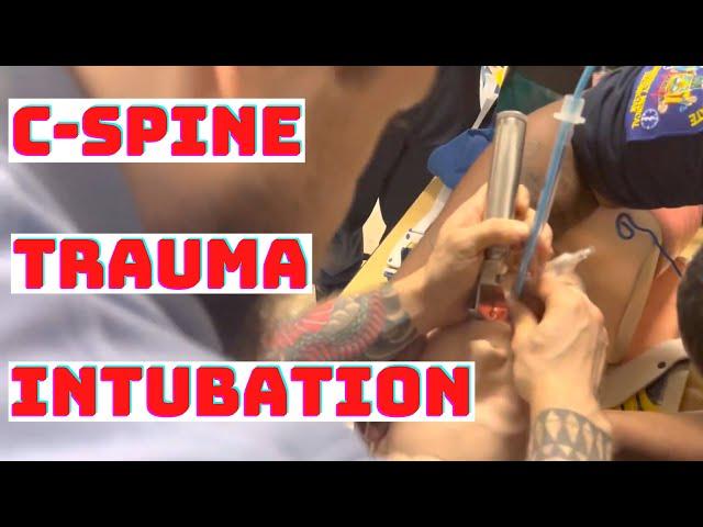 How to Intubate Cervical Spine (C-Spine)Trauma Injury Patient? MAC DL Standard Geometry