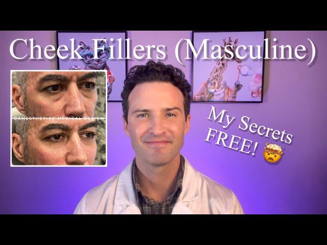 Cheek Fillers (Masculine face) My technique