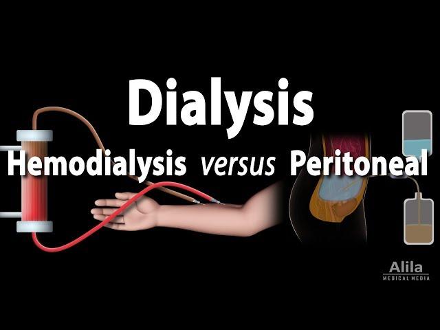 Renal Replacement Therapy: Hemodialysis vs Peritoneal Dialysis, Animation