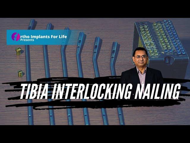 Tibia Interlocking Nail | Implants and Instruments