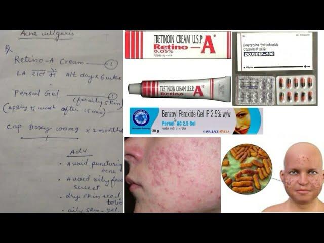 Acne vulgaris treatment in hindi by typical prescription made by general practitioner