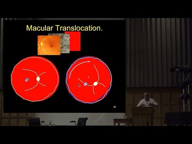 Curing blindness with stem cell therapy - Professor Peter Coffey (UCL) (BioFest)