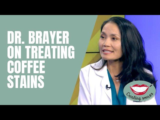 How To Treat & Prevent Coffee Stains | Cosmetic Dentist in Clearwater, FL | St. Petersburg, FL