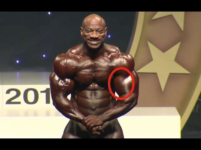 Is Dexter Jackson Using Synthol???