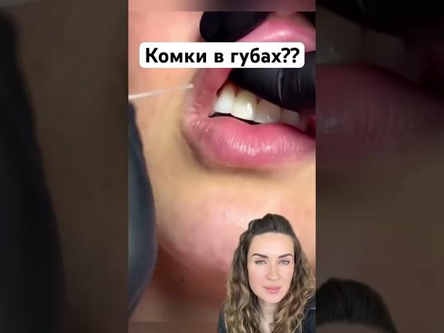 Как избавиться от геля, который скомковался? #уколыкрасоты #омоложение #губы #морщины #ботокс #топ