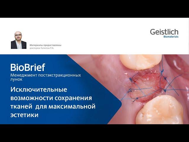 Исключительные возможности сохранения тканей для максимальной эстетики