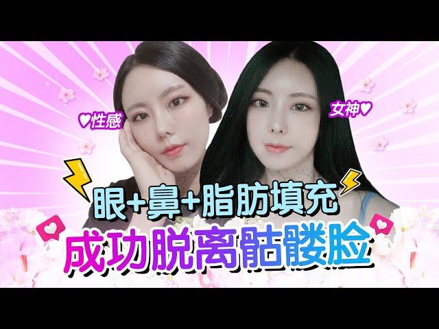 【韩国整形】眼+鼻+面部脂肪填充=在DA全脸打造Vlog️