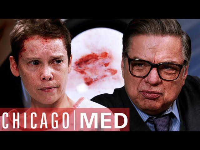 This Woman Thinks Parasites Are Growing Under her Skin | Chicago Med