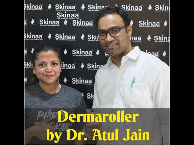 Dermaroller Treatment by Dr .Atul Jain | Viral #shorts