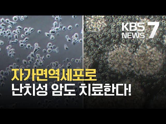 자가면역세포로 암 치료 시대…“재발성 교모세포종도 호전” / KBS 2021.03.15.