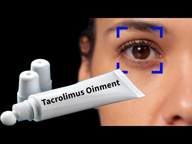 Stop Doing this! | Tacrolimus Oinment & Lotion