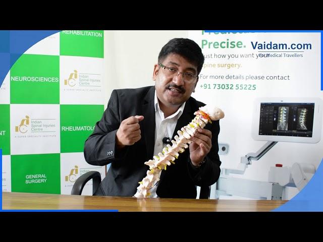 Cervical Spondylosis - Best Explained by Dr. Neeraj Gupta of ISIC, New Delhi