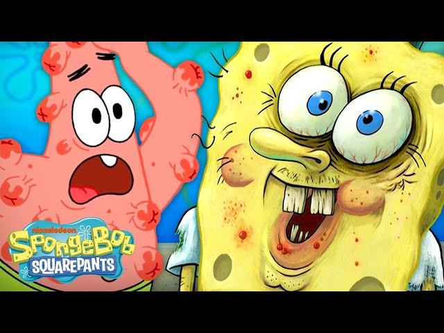 Every Bikini Bottom BREAK-OUT Ever  | SpongeBob