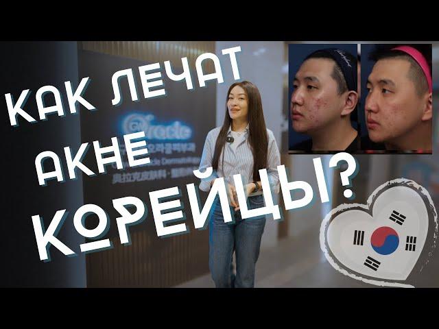 АКНЕ в Корее/ Как лечить? Как похудеть? Пластика? 2024