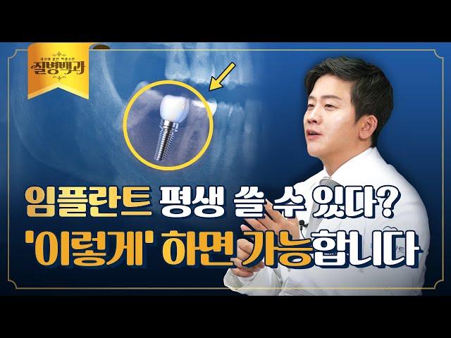 임플란트 평생 쓸 수 있다? 임플란트 수명 늘리려면 '이렇게' 하세요 | 질병백과