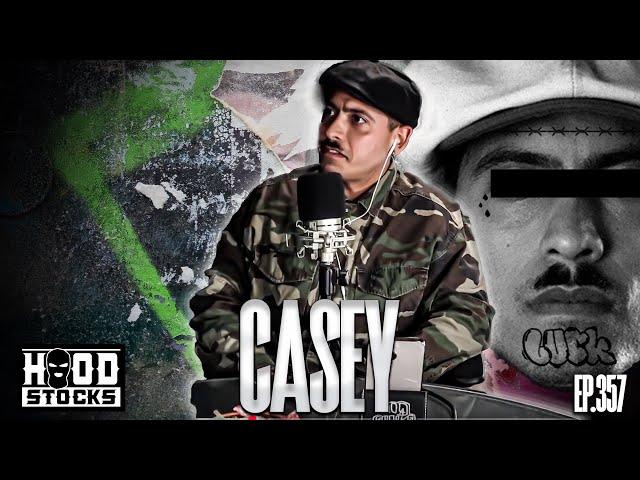 CASEY- first INTERVIEW   EP.  357