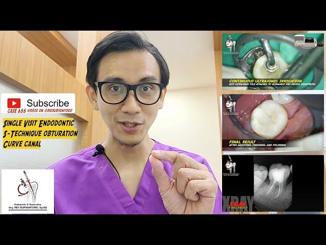 SINGLE VISIT ENDODONTIC ON MOLAR WITH SQUIRTING OBTURATION ROOT CANAL - PERAWATAN SALURAN AKAR GIGI