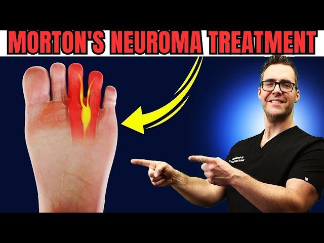 Numbness or Tingling in the Feet or Toes? [Morton's Neuroma Treatment]